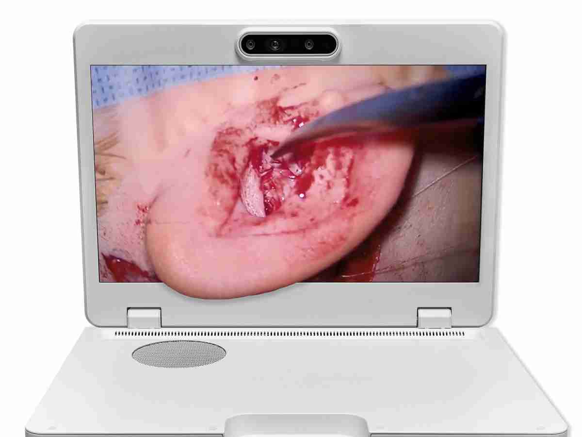 达擎之＂Heads-up 3D显微手术显示系统＂，，，整合4K裸眼3D显示及眼球追踪系统，，，具备快速追踪人眼移动位置功能，，减轻医师长时间维持固定姿势的负担，，让医师能有更宽广清晰的3D立体视野及更舒适的姿势来执行手术。。